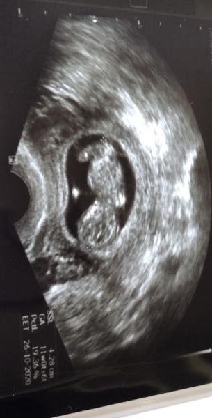 Bild zu Hallo ihr Lieben - Forum für Oktober - Mamis