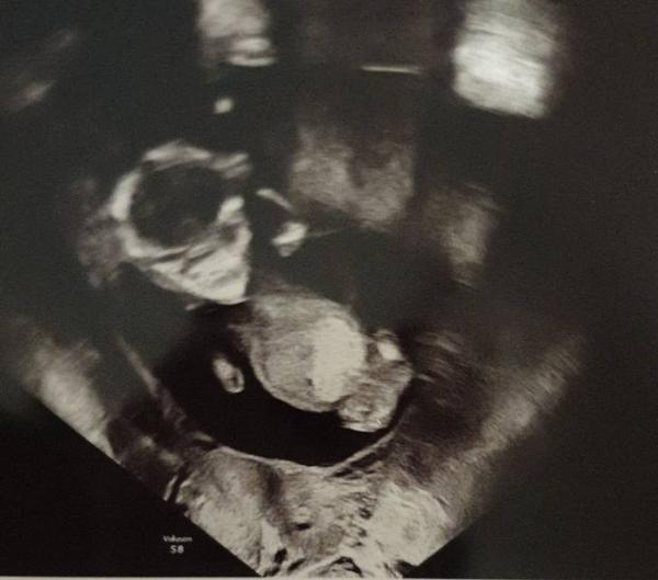Bild zu Gerade aus dem KH zurück - Forum für Oktober - Mamis