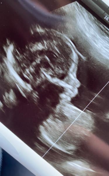 Bild zu Wer fühlt sich nach dem Outing auch „enttäuscht“? - Forum für Oktober - Mamis