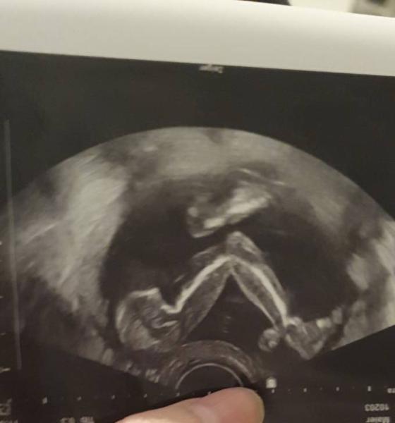 Bild zu Tendenzielles Outing + Baby is ein clown - Forum für Oktober - Mamis