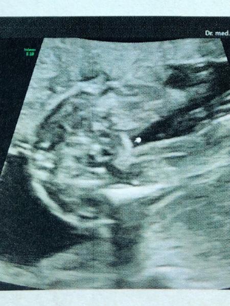 Bild zu Geschlecht erkennen ? - Forum für Oktober - Mamis