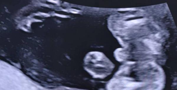 Bild zu Re: Geschlecht? - Forum für Oktober - Mamis