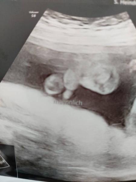 Bild zu Ultraschal - Forum für Oktober - Mamis