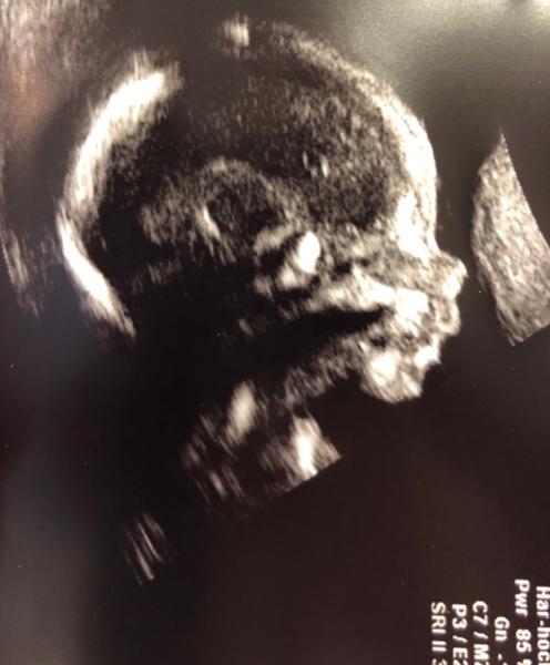 Bild zu Auch zurück vom Organscreening 💙 - Forum für Oktober - Mamis