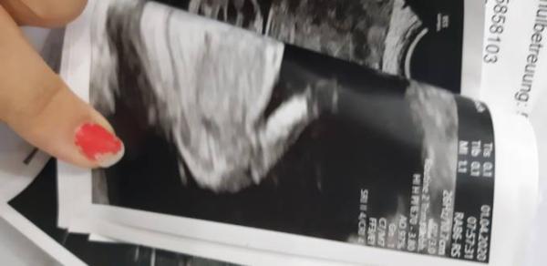 Bild zu Kennt sich jemand mit der Nub Theorie aus? - Forum für Oktober - Mamis