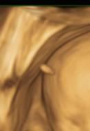 Bild zu Was kann das sein? 3D-US-Bild - Forum für Oktober - Mamis