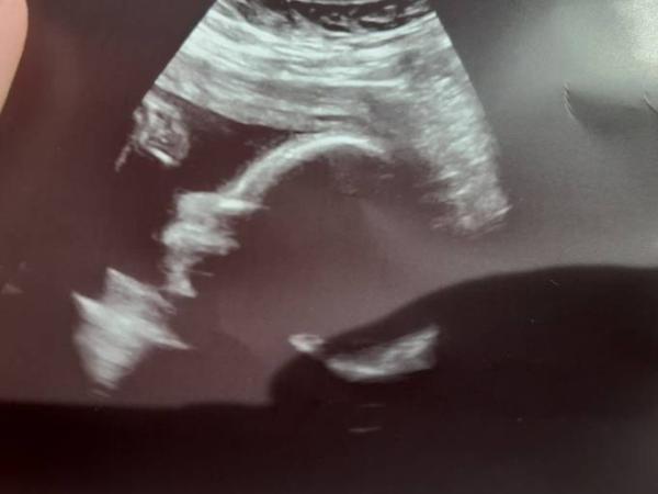 Bild zu Heute Fa Termin  - Forum für Oktober - Mamis