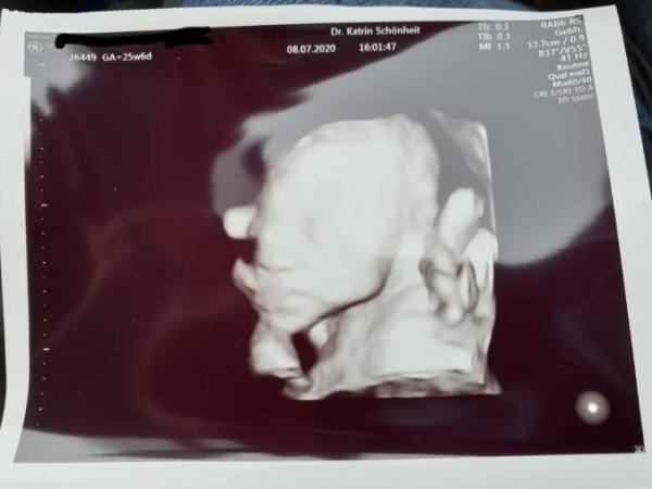 Bild zu Zuckertest und Ultraschall 😊 - Forum für Oktober - Mamis