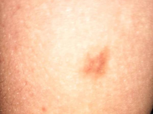 Bild zu @Ani.Me / was könnte das sein? - Forum für Oktober - Mamis