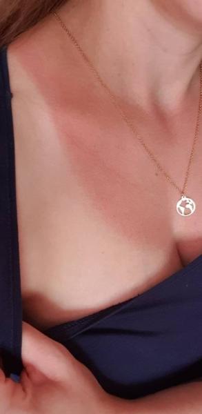 Bild zu Sonnenbrad - Forum für Oktober - Mamis