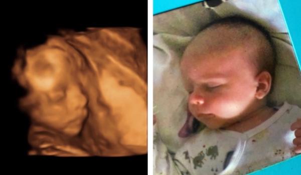 Bild zu Ist die Ähnlichkeit nicht verblüffend? - Forum für Oktober - Mamis