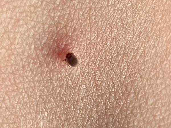 Bild zu Gleich beim ersten Mal/ Silopo! - Forum für Oktober - Mamis