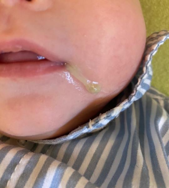 Bild zu Grünlicher schleim🤷‍♀️ - Forum für Oktober - Mamis