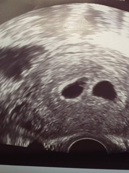 Bild zu Heute die große Überraschung- ultraschall  - Forum für Oktober - Mamis