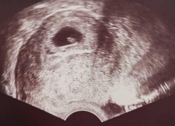 Bild zu Marienkäferchen gesichtet! - Forum für Oktober - Mamis