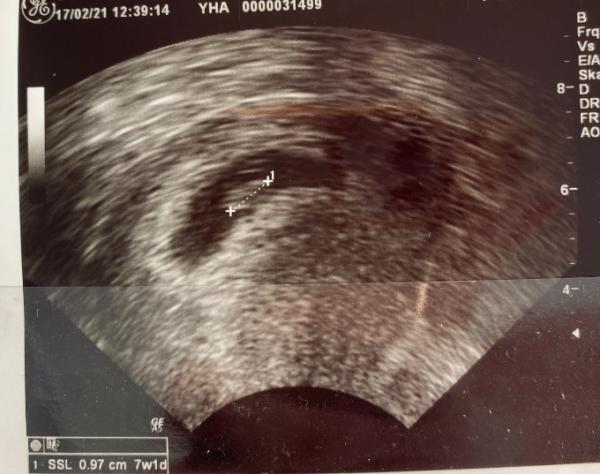 Bild zu Termin bei der Frauenärztin... - Forum für Oktober - Mamis