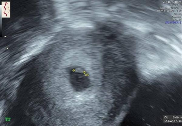 Bild zu 1. Fa-Termin - Forum für Oktober - Mamis