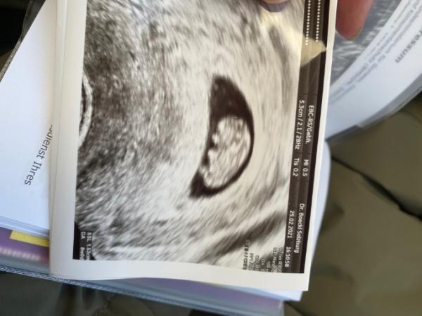 Bild zu Ultraschall 8+0 - Forum für Oktober - Mamis