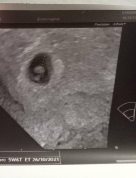 Bild zu 1. FA Besuch - Forum für Oktober - Mamis
