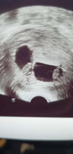 Bild zu Update ultraschall  - Forum für Oktober - Mamis