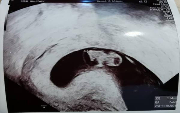 Bild zu Es ist alles gut 🥰 - Forum für Oktober - Mamis