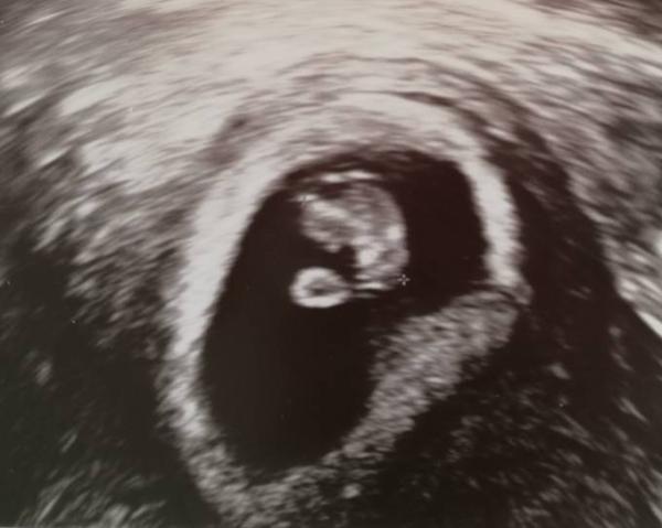 Bild zu 1. FA Besuch :) - Forum für Oktober - Mamis