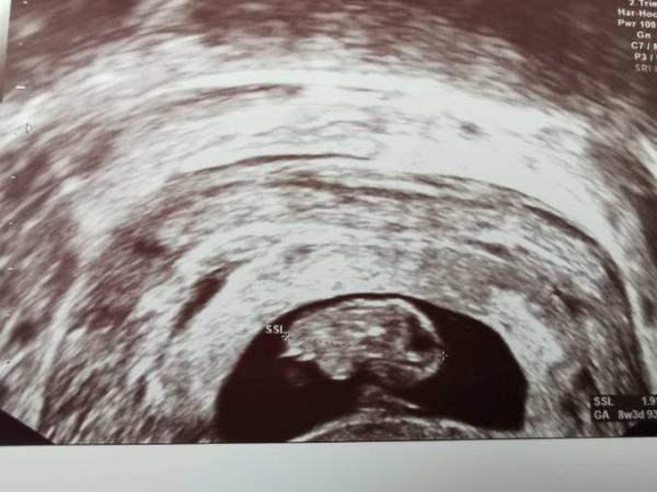 Bild zu 2. FA Termin - Forum für Oktober - Mamis