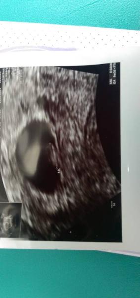 Bild zu Heute termin zum US - Forum für Oktober - Mamis