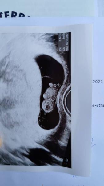 Bild zu Alles gut mit dem Gummibärchen - Forum für Oktober - Mamis