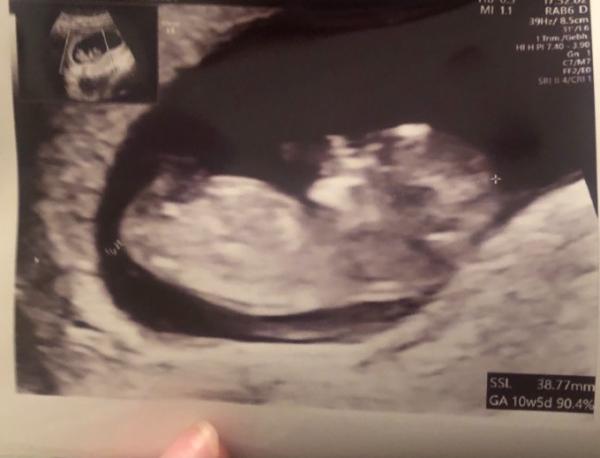 Bild zu So schön 🥰 - Forum für Oktober - Mamis