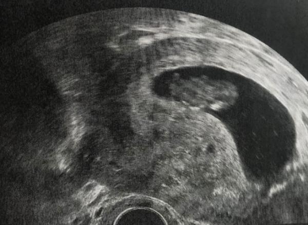 Bild zu 1. Termin bei 10+6 - Forum für Oktober - Mamis
