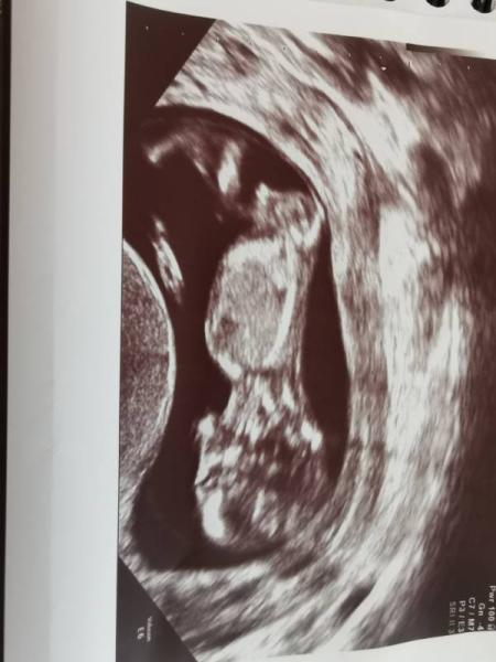 Bild zu 12. Woche FA Termin - Forum für Oktober - Mamis
