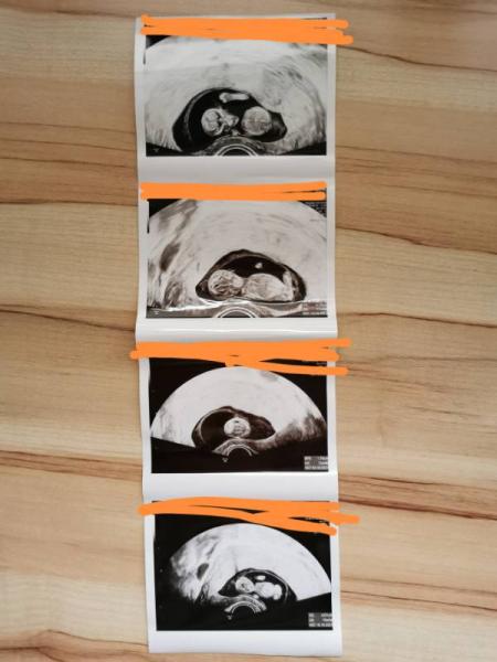 Bild zu 1. Vorsorgetermin 🥰 - Forum für Oktober - Mamis