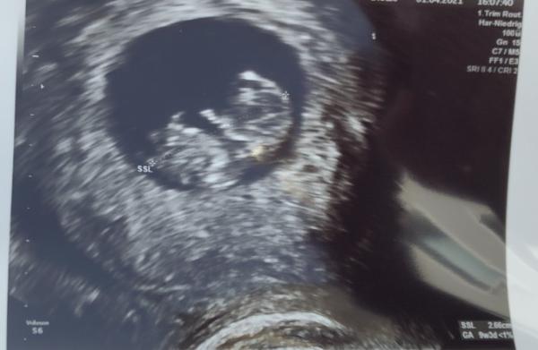 Bild zu Heute FA ich muss in den November Umsteigen. - Forum für Oktober - Mamis
