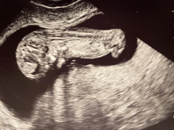 Bild zu Bitte bei mir auch mal NUB Theorie - Forum für Oktober - Mamis
