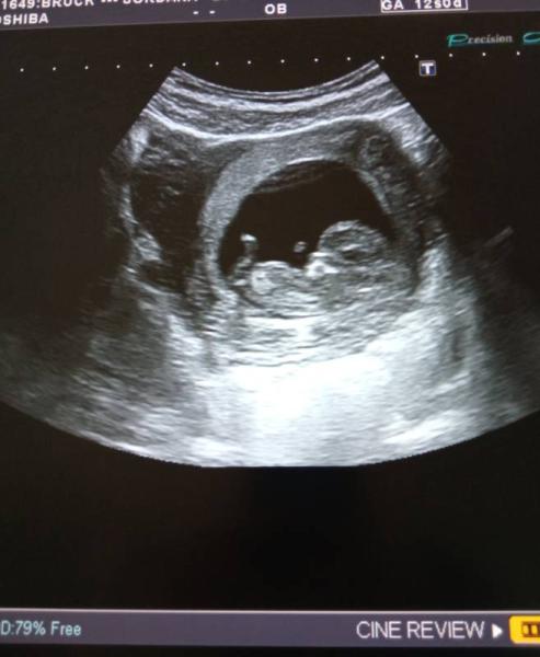 Bild zu Positives - Forum für Oktober - Mamis