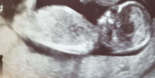 Bild zu Nun Theorue - Forum für Oktober - Mamis