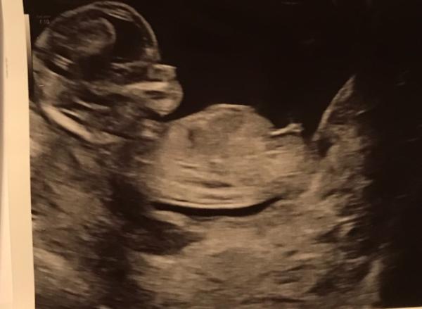 Bild zu Nub Experten gesucht - Forum für Oktober - Mamis
