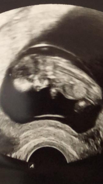 Bild zu Nub Theorie - Forum für Oktober - Mamis