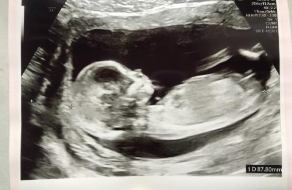 Bild zu Ich will auch 🎉 (NUB) - Forum für Oktober - Mamis