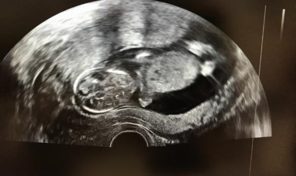 Bild zu 2. FA Termin - Forum für Oktober - Mamis