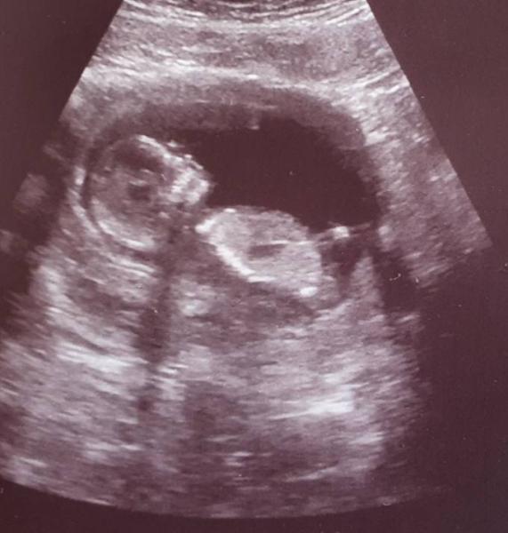 Bild zu NUB? - Forum für Oktober - Mamis