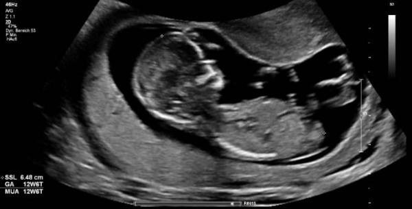 Bild zu Nub Theorie - Forum für Oktober - Mamis