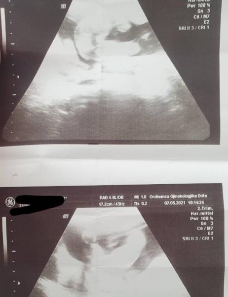 Bild zu Mädchen oder Junge - Forum für Oktober - Mamis