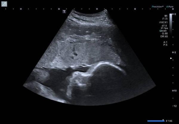 Bild zu Aufgehohlt - Forum für Oktober - Mamis