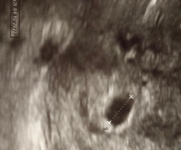 Bild zu Erstes Us bildchen 🥰 5+2 - Forum für Oktober - Mamis