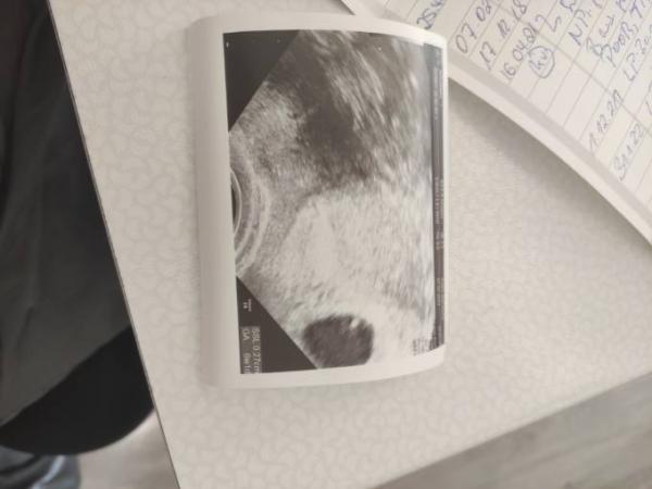 Bild zu Freude teilen! - Forum für Oktober - Mamis