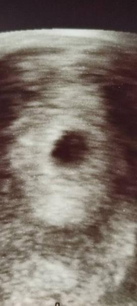 Bild zu Hier sind wir 😍 - Forum für Oktober - Mamis