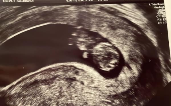 Bild zu Update 8+6 - Forum für Oktober - Mamis