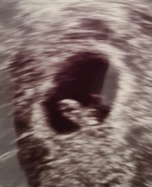 Bild zu 7+5.ssw mit Bildchen - Forum für Oktober - Mamis